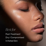 Post Treatment Balm (formerly Post Peel Balm) - Retail