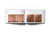 Before & After Book - Dermaceutic
