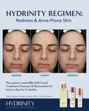 PRELUDE Facial Treatment Cleanser
