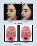 PRELUDE Facial Treatment Cleanser